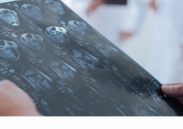 Omezení a následné dočasné uzavření provozu neurologické ambulance